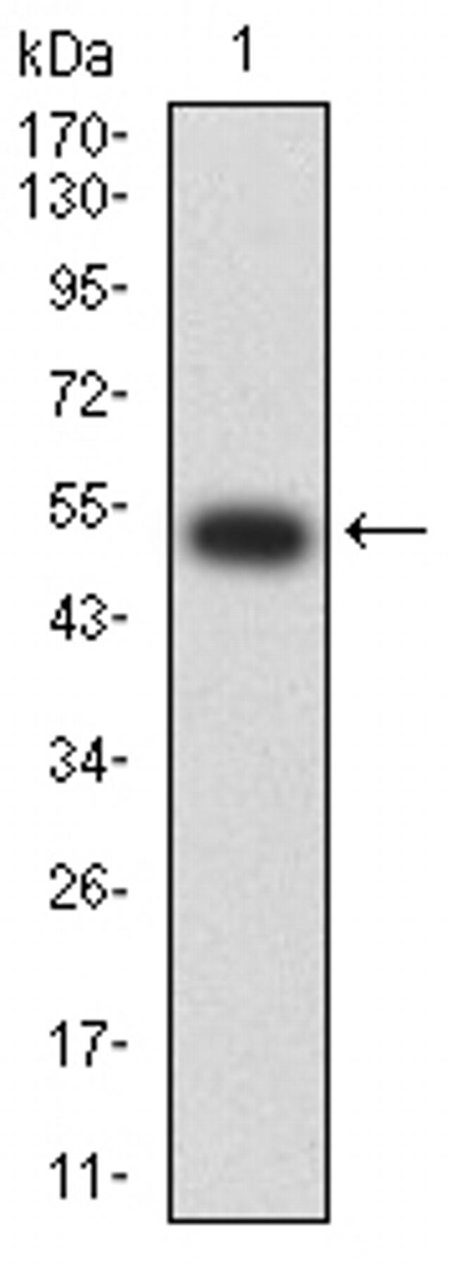 CHRNB2 Antibody in Western Blot (WB)