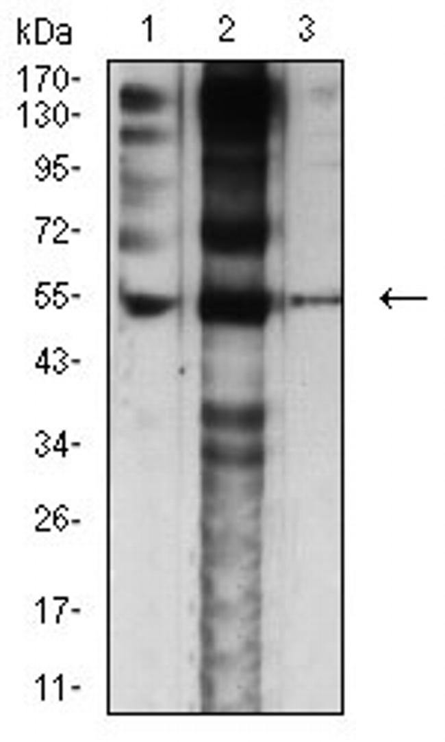 CHRNE Antibody in Western Blot (WB)