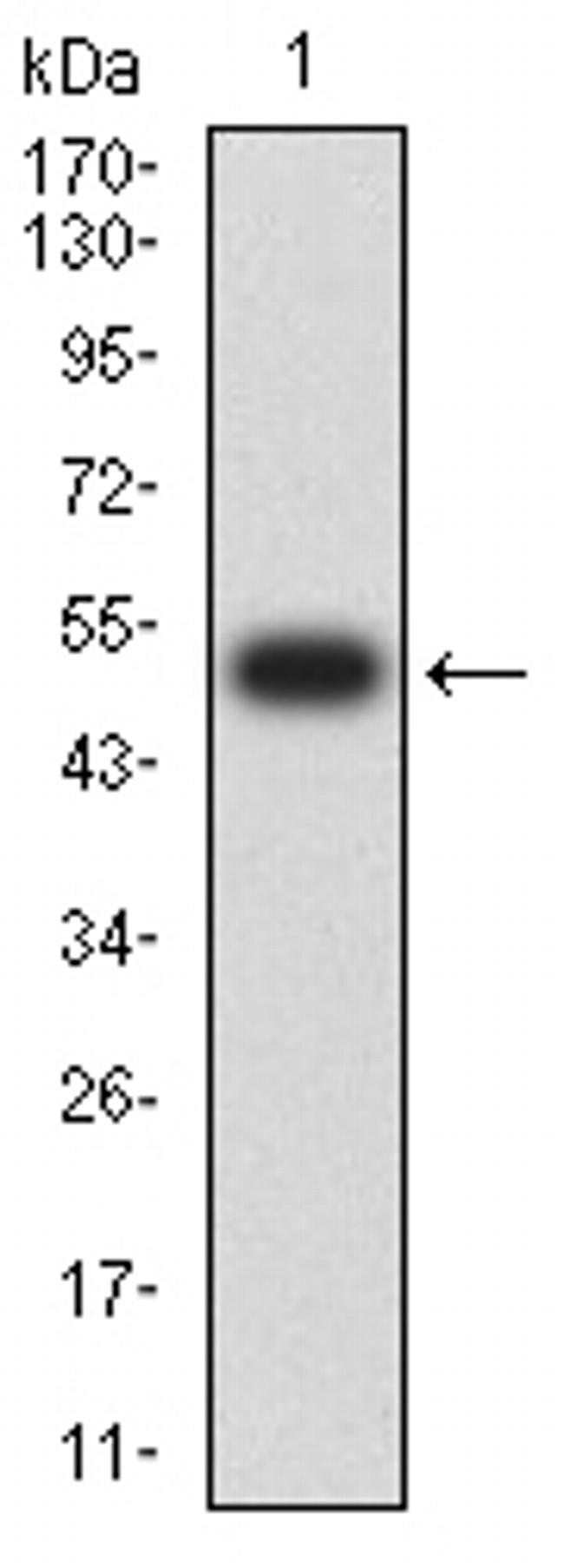 CHRNE Antibody in Western Blot (WB)