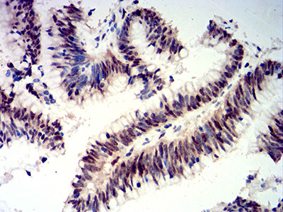 CIRBP Antibody in Immunohistochemistry (Paraffin) (IHC (P))