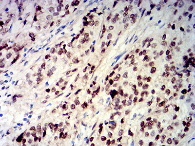 CIRBP Antibody in Immunohistochemistry (Paraffin) (IHC (P))