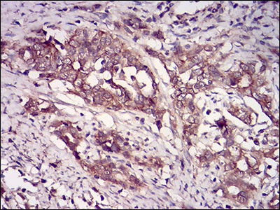 CK2 beta Antibody in Immunohistochemistry (Paraffin) (IHC (P))