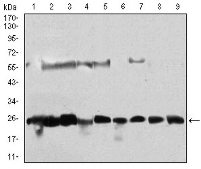 CK2 beta Antibody in Western Blot (WB)