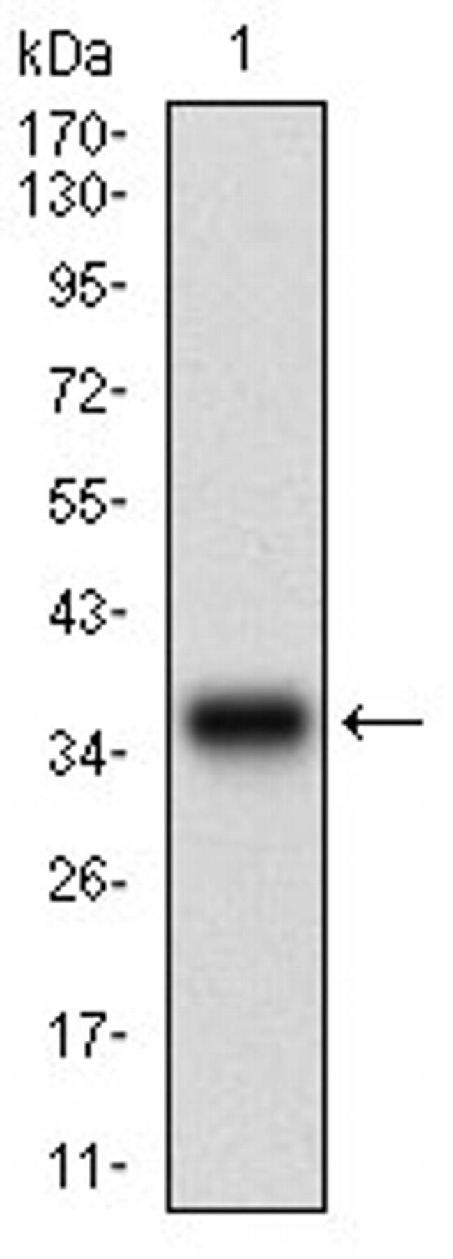 CK2 beta Antibody in Western Blot (WB)