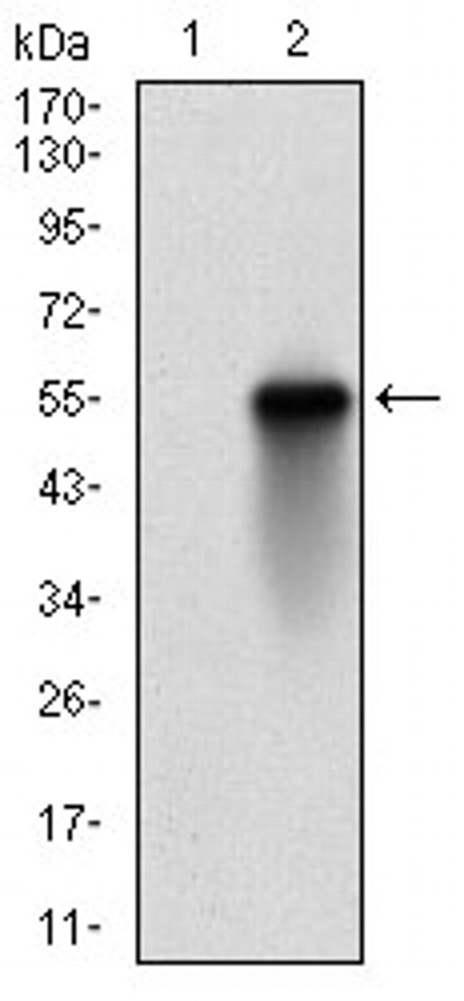 CK2 beta Antibody in Western Blot (WB)