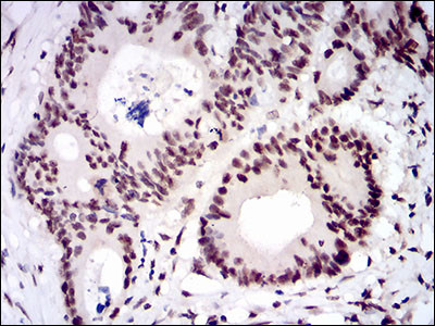 CTNNBL1 Antibody in Immunohistochemistry (Paraffin) (IHC (P))