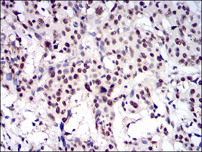 CTNNBL1 Antibody in Immunohistochemistry (Paraffin) (IHC (P))