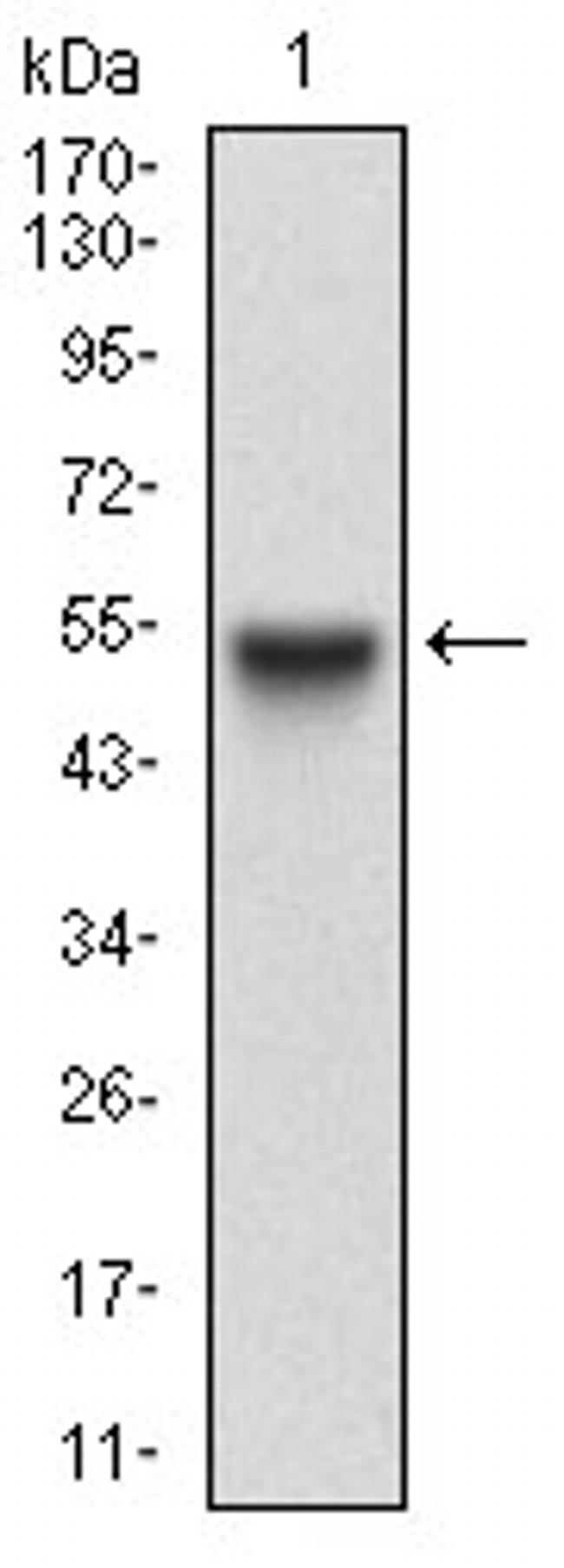 CTNNBL1 Antibody in Western Blot (WB)