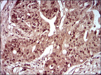 ZIPK Antibody in Immunohistochemistry (Paraffin) (IHC (P))