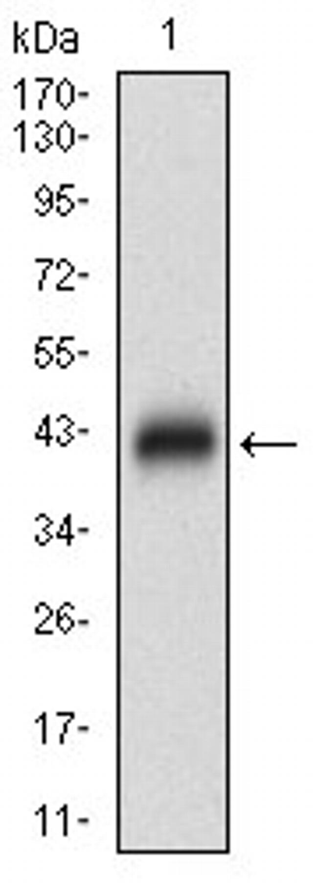 ZIPK Antibody in Western Blot (WB)