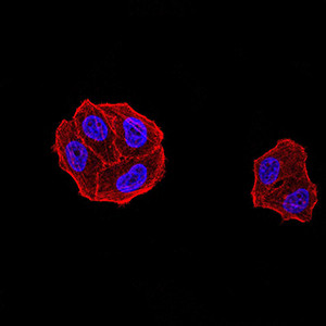 DDX1 Antibody in Immunocytochemistry (ICC/IF)