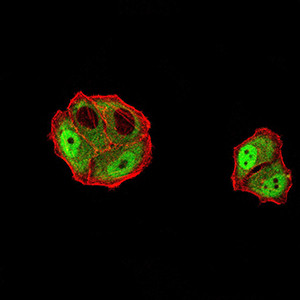 DDX1 Antibody in Immunocytochemistry (ICC/IF)