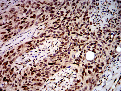 DDX1 Antibody in Immunohistochemistry (Paraffin) (IHC (P))