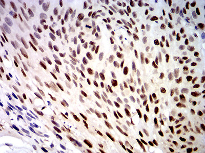 DDX1 Antibody in Immunohistochemistry (Paraffin) (IHC (P))