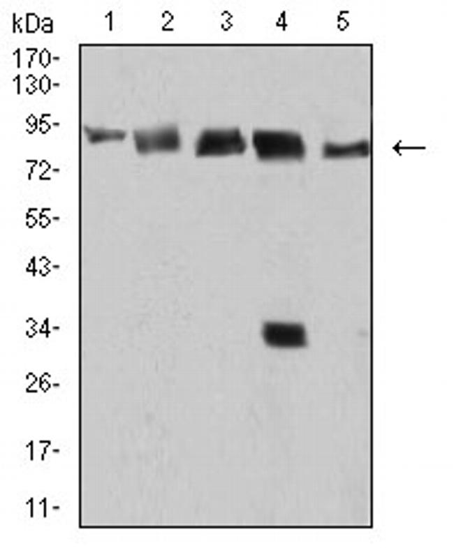 DDX1 Antibody in Western Blot (WB)