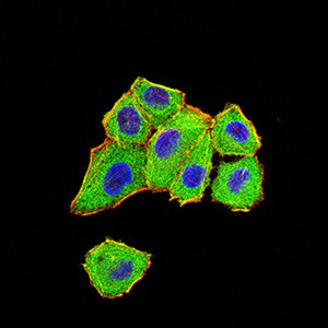 DDX1 Antibody in Immunocytochemistry (ICC/IF)