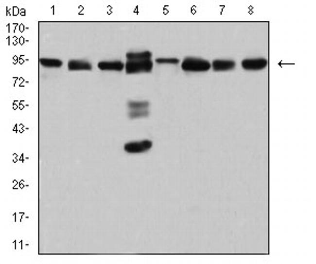 DDX1 Antibody in Western Blot (WB)