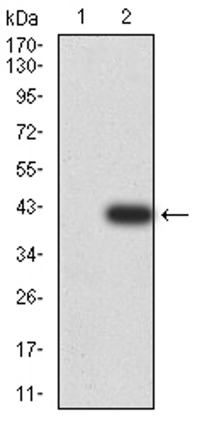 DDX1 Antibody in Western Blot (WB)