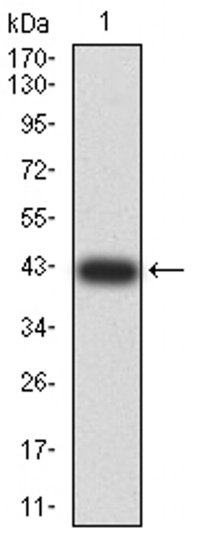 RIG-I Antibody in Western Blot (WB)