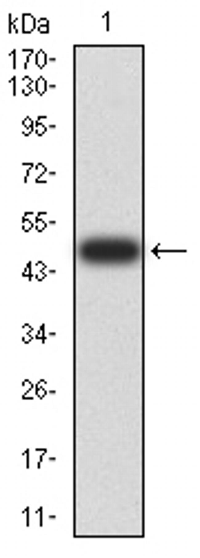 LGP2 Antibody in Western Blot (WB)