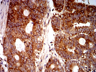 eIF5 Antibody in Immunohistochemistry (Paraffin) (IHC (P))