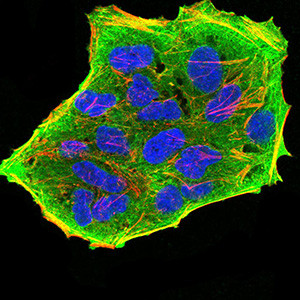 GFPT1 Antibody in Immunocytochemistry (ICC/IF)