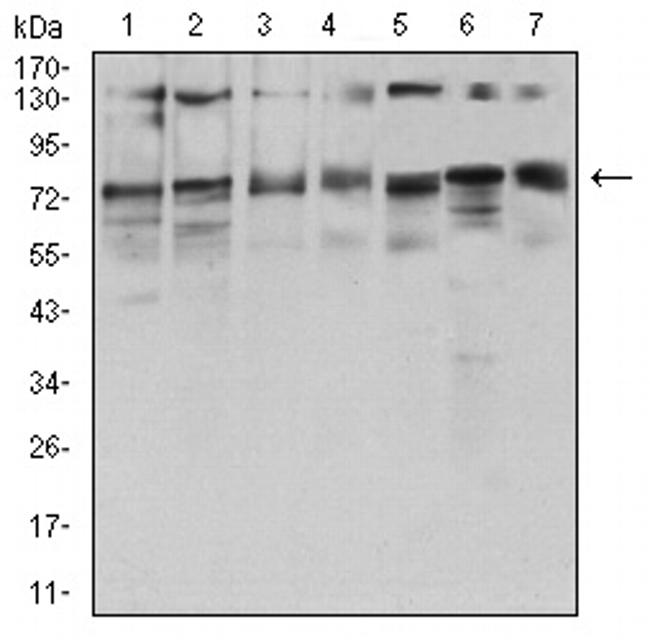 GFPT1 Antibody in Western Blot (WB)