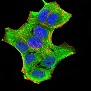 GFPT1 Antibody in Immunocytochemistry (ICC/IF)