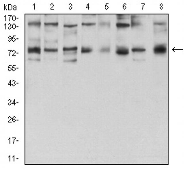 GFPT1 Antibody in Western Blot (WB)