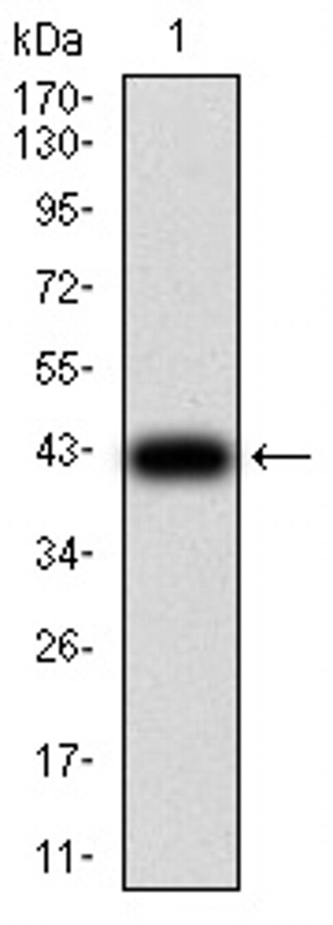 GFPT1 Antibody in Western Blot (WB)