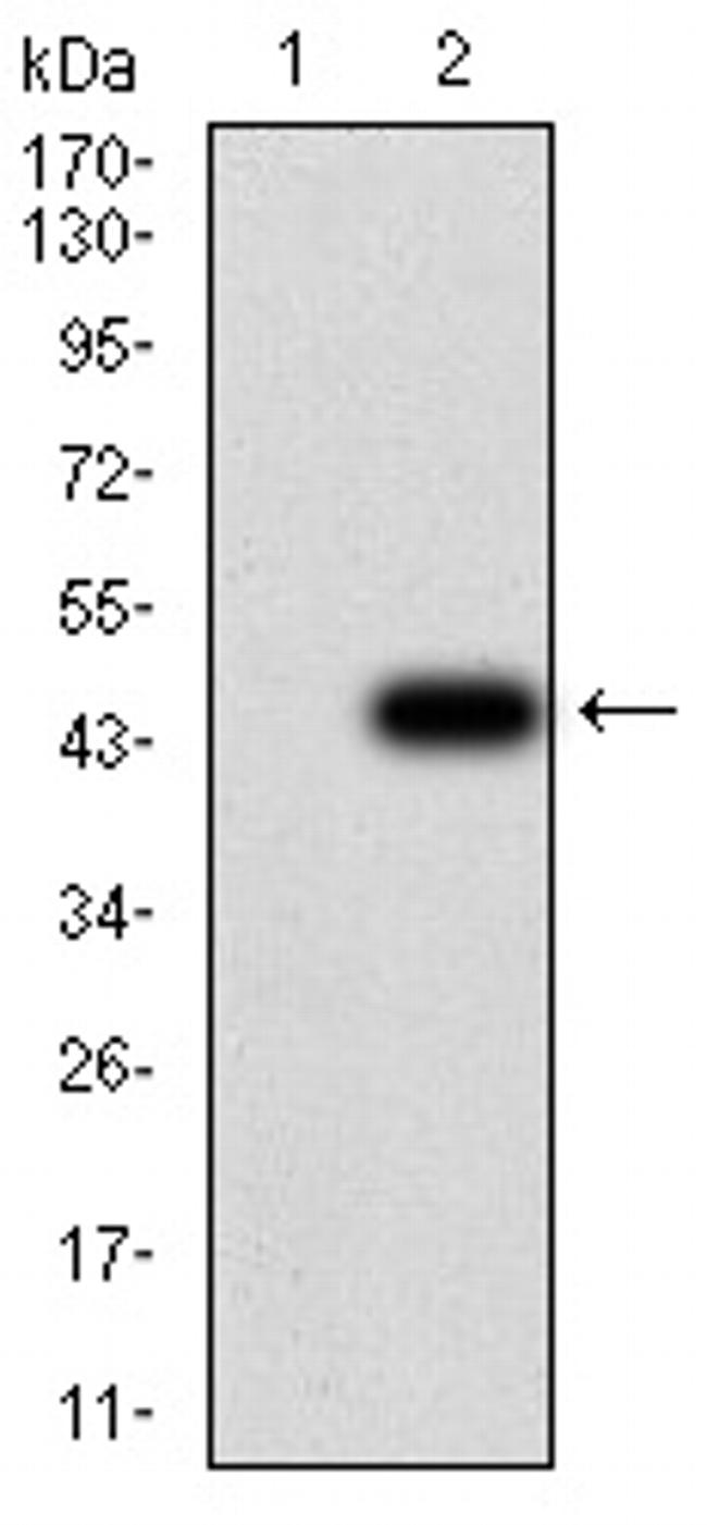 GFPT1 Antibody in Western Blot (WB)