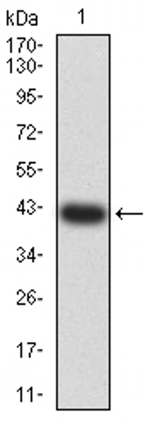 GluR7 Antibody in Western Blot (WB)