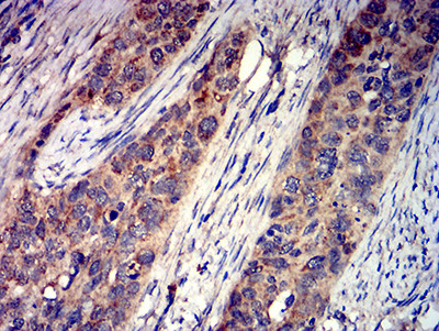 GRIK4 Antibody in Immunohistochemistry (Paraffin) (IHC (P))