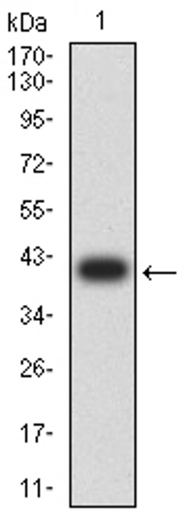 NMDAR3B Antibody in Western Blot (WB)