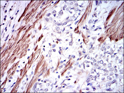 GSTM1 Antibody in Immunohistochemistry (Paraffin) (IHC (P))