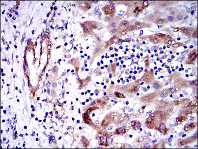 GSTM1 Antibody in Immunohistochemistry (Paraffin) (IHC (P))