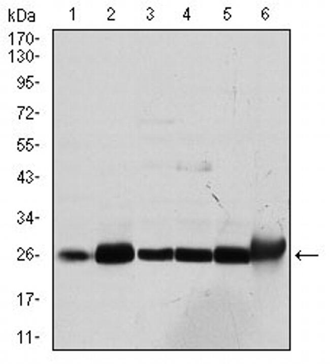 GSTM1 Antibody in Western Blot (WB)