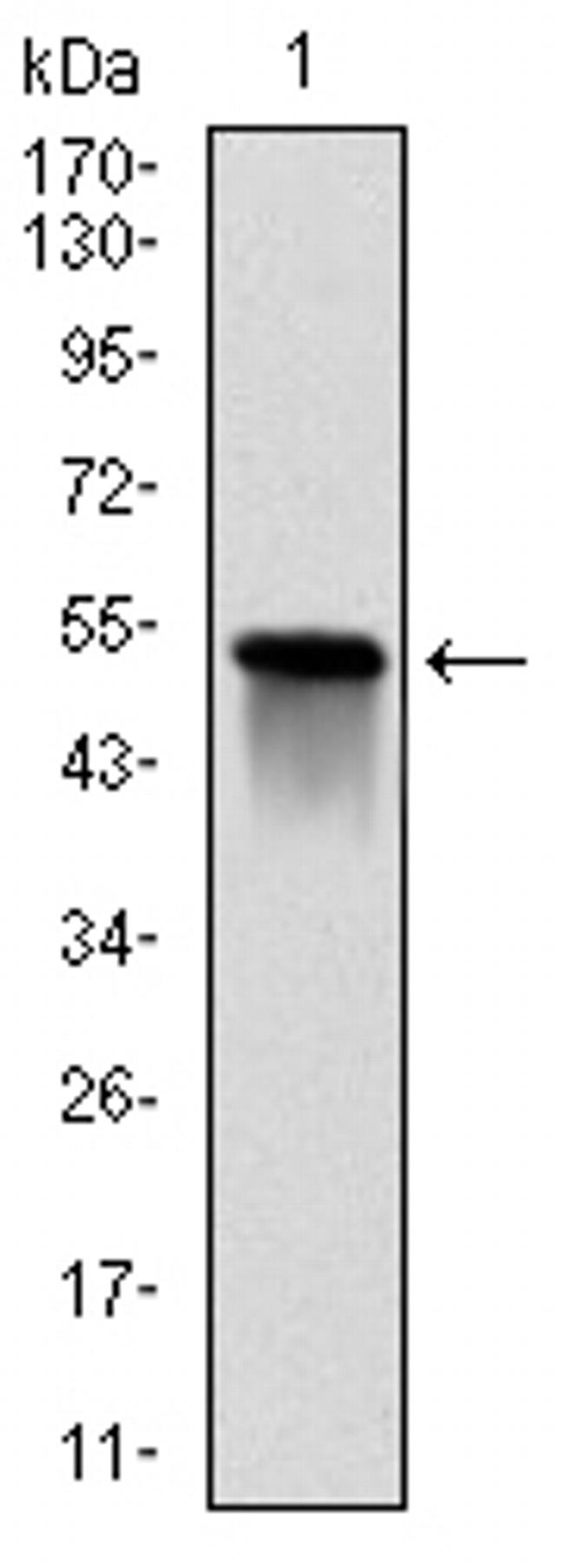 GSTM1 Antibody in Western Blot (WB)