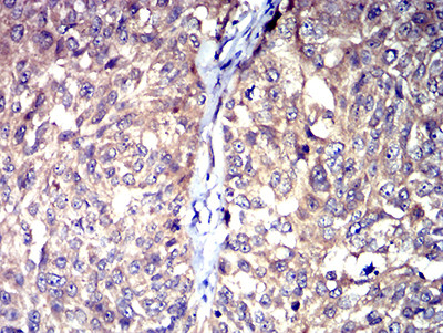 HTR3A Antibody in Immunohistochemistry (Paraffin) (IHC (P))