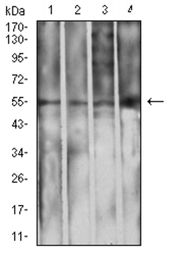 IGHA1 Antibody in Western Blot (WB)