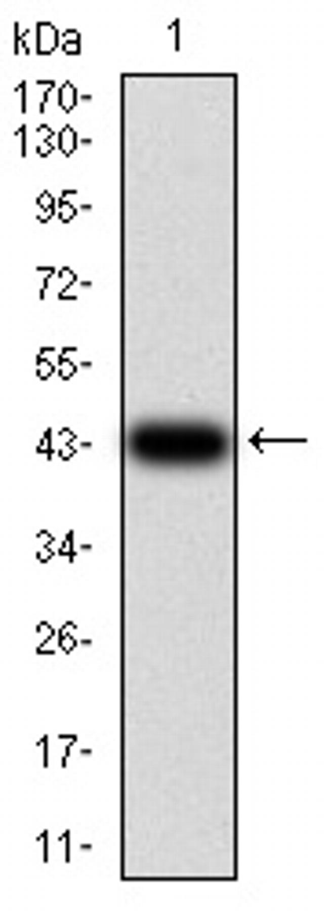 IL1RAPL1 Antibody in Western Blot (WB)