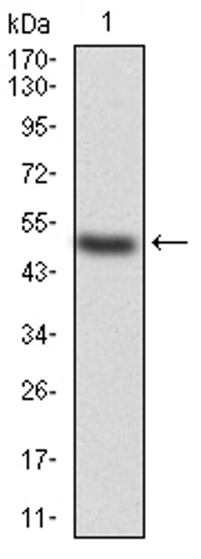 KBTBD8 Antibody in Western Blot (WB)