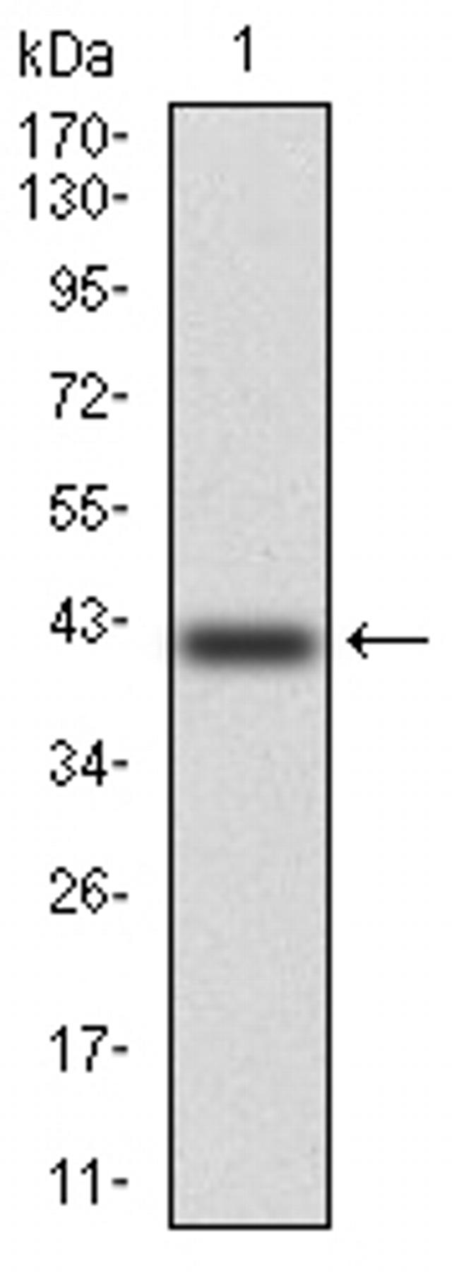 KV4.2 (KCND2) Antibody in Western Blot (WB)