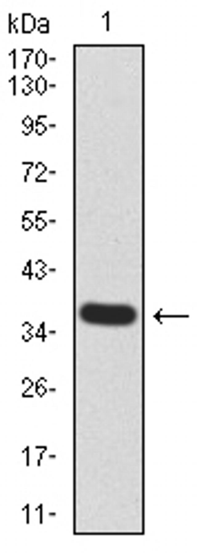 KDM5B Antibody in Western Blot (WB)