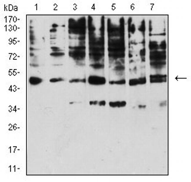 KIR3DL1 Antibody in Western Blot (WB)