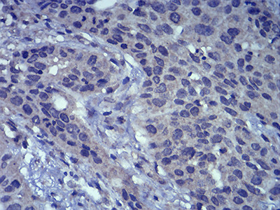 LEF1 Antibody in Immunohistochemistry (Paraffin) (IHC (P))