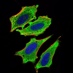 ChREBP Antibody in Immunocytochemistry (ICC/IF)