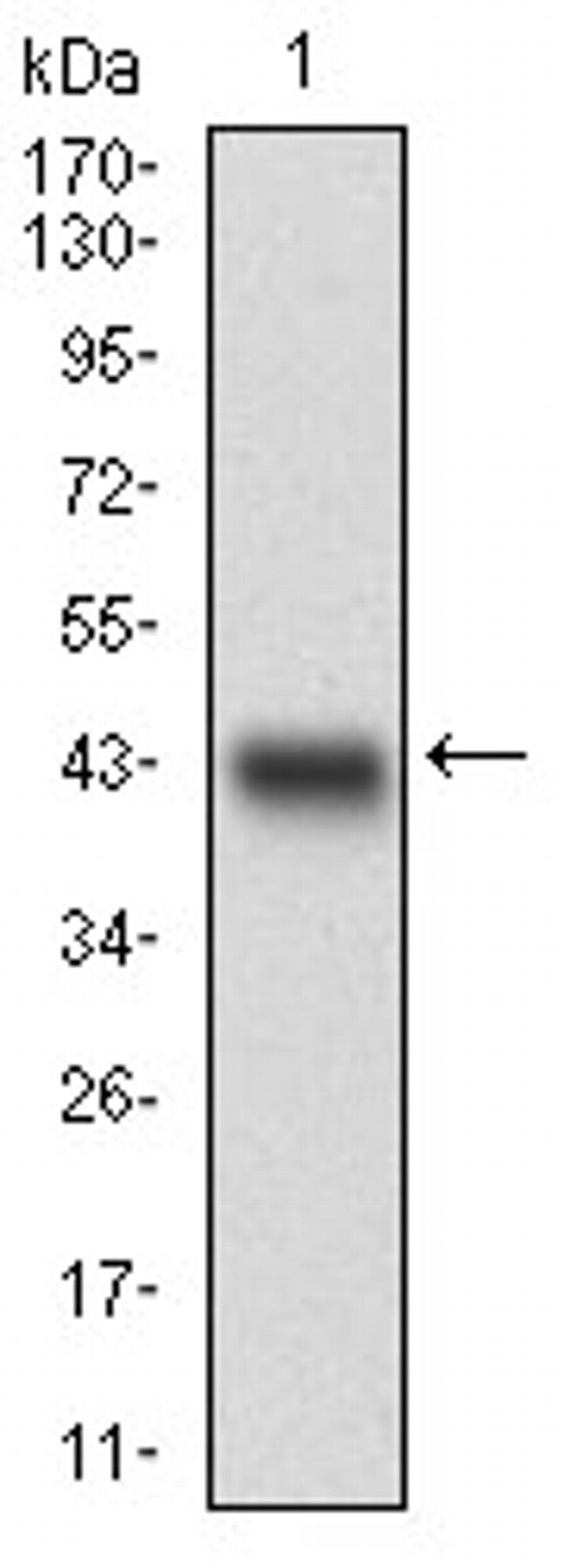 ChREBP Antibody in Western Blot (WB)