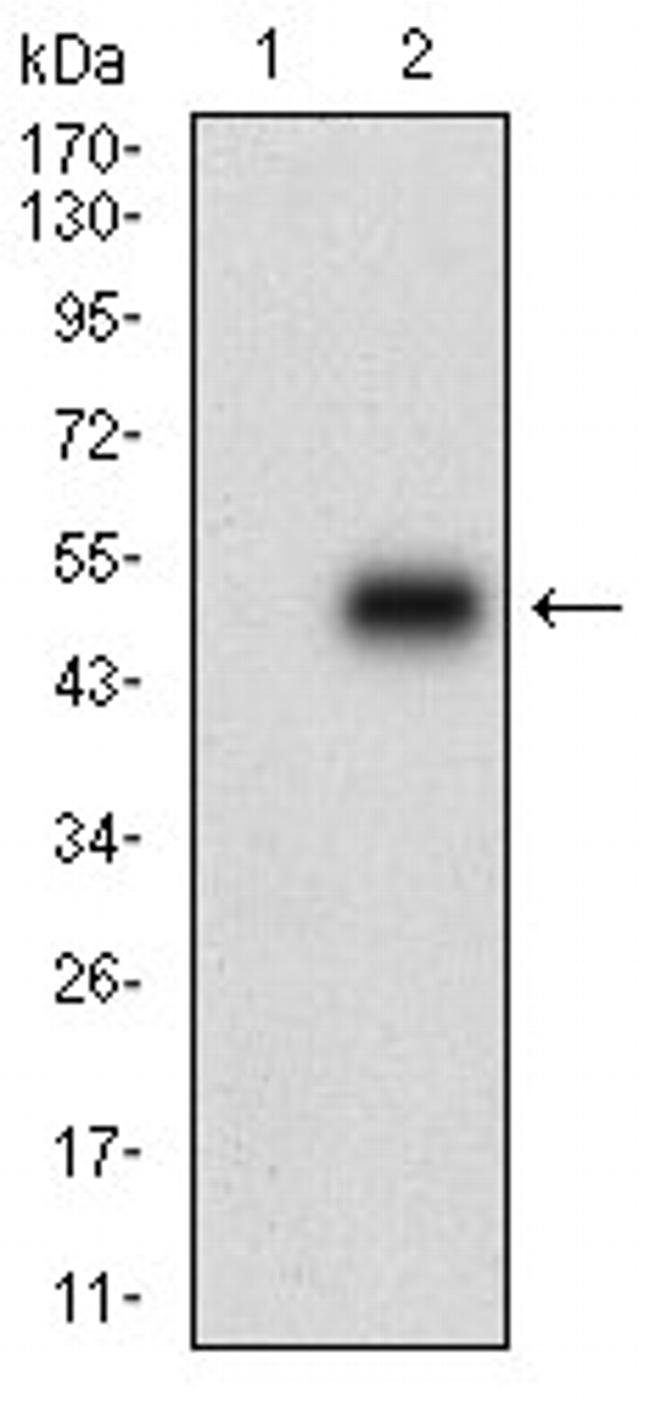 ChREBP Antibody in Western Blot (WB)