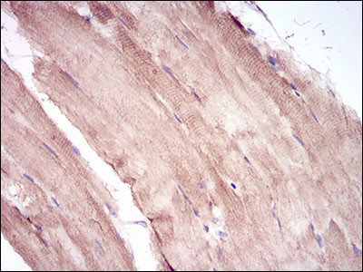 MURF1 Antibody in Immunohistochemistry (Paraffin) (IHC (P))